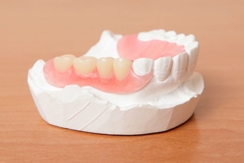 Why Getting Quality Dentures is the Way to Go