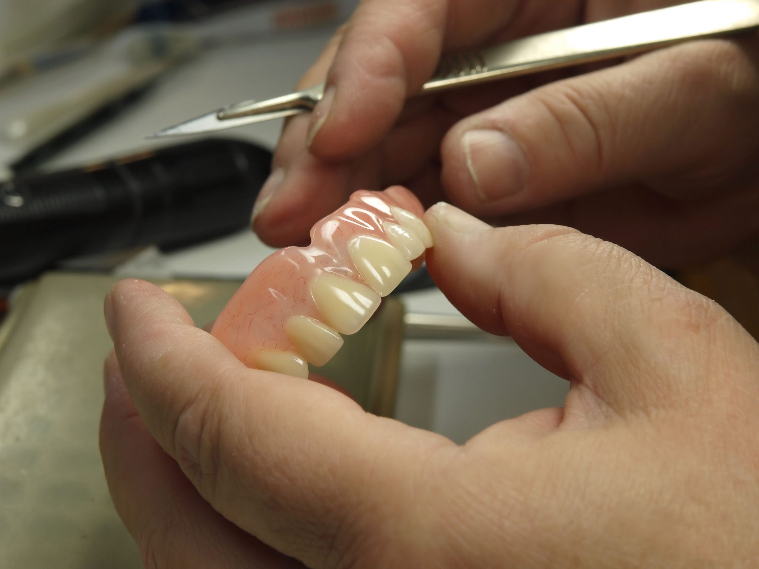 Why It Is Important to Replace Missing Teeth
