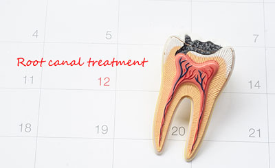 Visit a Root Canal Dentist to Have an Infection Removed